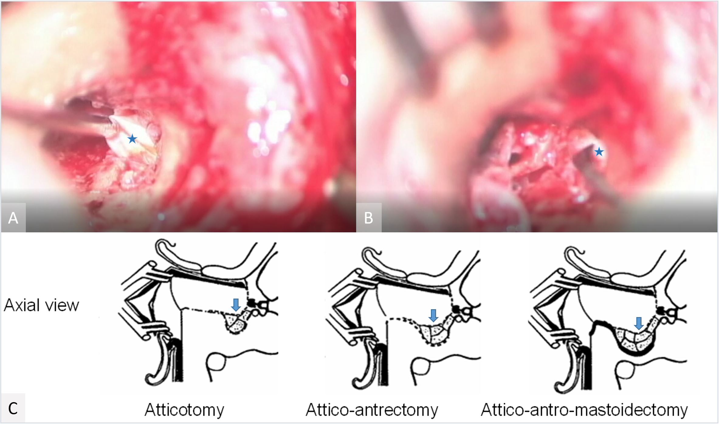 Figure of TTCR.JPG